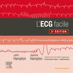 L'ECG facile 3e édition