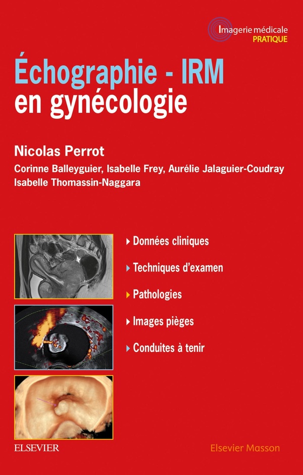 GUIDE D'IMAGERIE EN GYNECOLOGIE